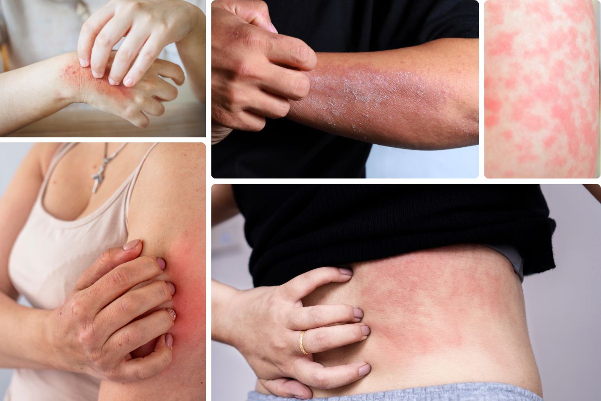 Nước sinh hoạt không đạt chuẩn có hại thế nào cho sức khỏe, da dẻ của trẻ em, phụ nữ?