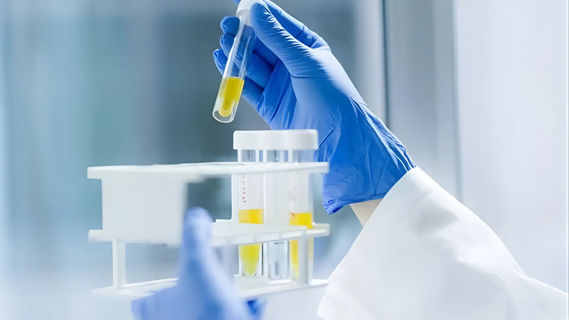 Hydro Sunfua h2s trong nuoc co hai nhu the nao va giai phap xu ly hieu qua Hydro Sunfua (h2s) trong nước có hại như thế nào và giải pháp xử lý hiệu quả Thế Giới Lọc Tổng